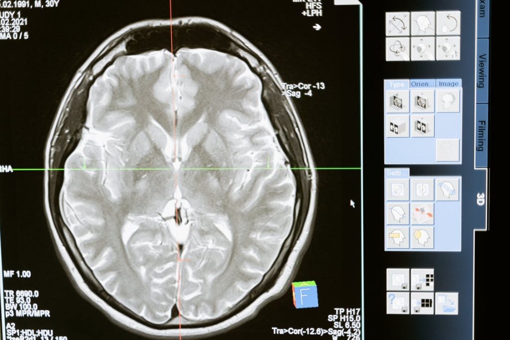 Identifying Symptoms of Neurological Injuries